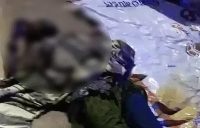 सड़क पर महिला को आग के हवाले कर भागा युवक, लोगों ने बुझाई आग, पुलिस ने दर्ज किया मामला
